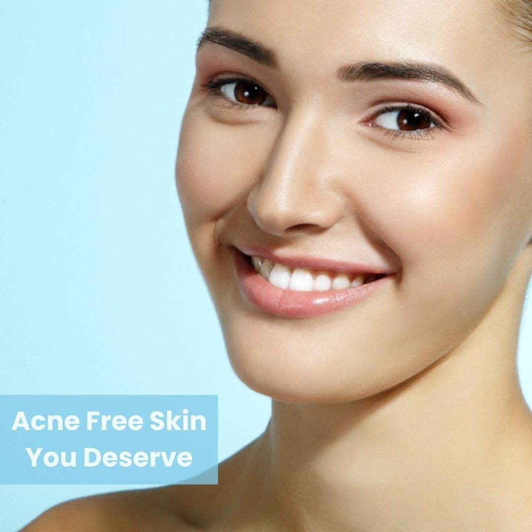 Anti Acne Face Wash 200mL - Herbalart